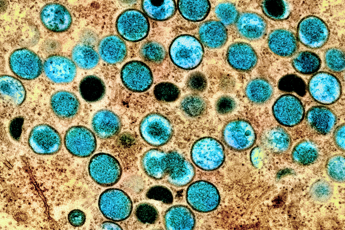 microscopic image of mpox