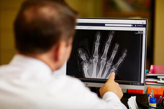 A health care provider pointing to an x-ray of a hand.